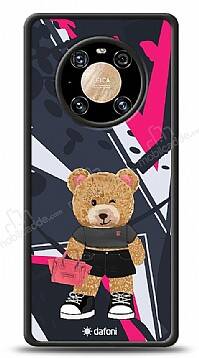 Dafoni Art Huawei Mate 40 Pro Rock And Roll Teddy Bear Kılıf - 1