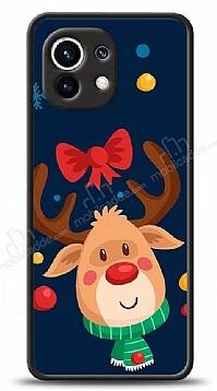 Dafoni Art Xiaomi Mi 11 Christmas Deer Kılıf - 1