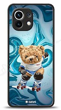 Dafoni Art Xiaomi Mi 11 Skating Teddy Bear Kılıf - 1