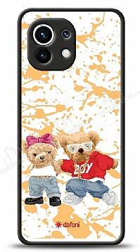 Dafoni Art Xiaomi Mi 11 Style Couple Teddy Kılıf - 1