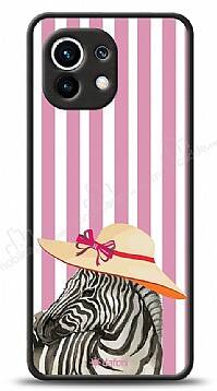 Dafoni Art Xiaomi Mi 11 Zebra Fashion Kılıf - 1