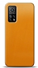 Dafoni Xiaomi Mi 10T / Mi 10T Pro Metalik Parlak Grnml Sar Telefon Kaplama