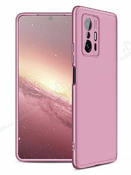 Zore GKK Ays Xiaomi 11T 360 Derece Koruma Rose Gold Rubber Kılıf - 1